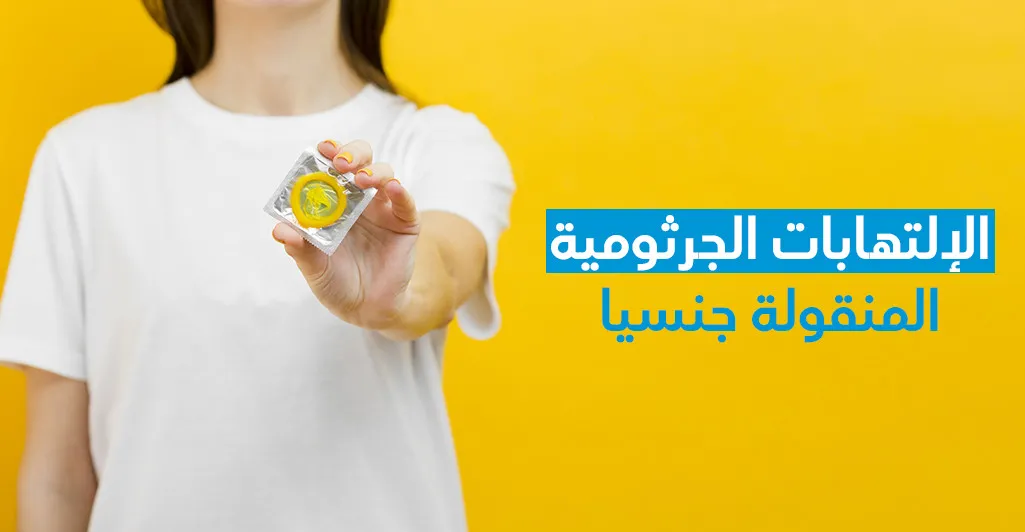 الإلتهابات الجرثوميّة المنقولة جنسيّا